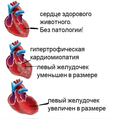 Симптомы сердечных патологий