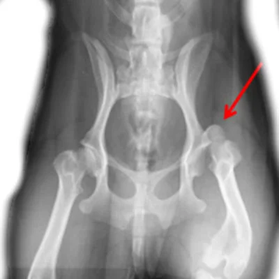 Рентген позволит увидеть, есть ли разрыв круглой связки